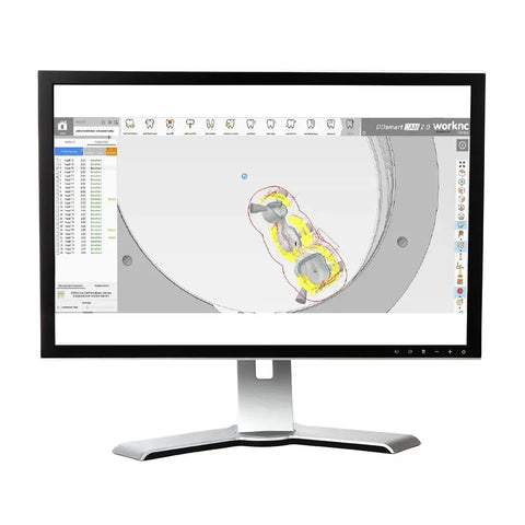 Dental Direkt DD Software smartcam