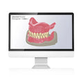 Dental Direkt Designer Full dentures